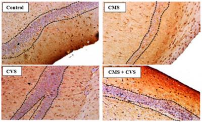 Caloric Vestibular Stimulation Induced Enhancement of Behavior and Neurotrophic Factors in Chronic Mild Stress Induced Rats